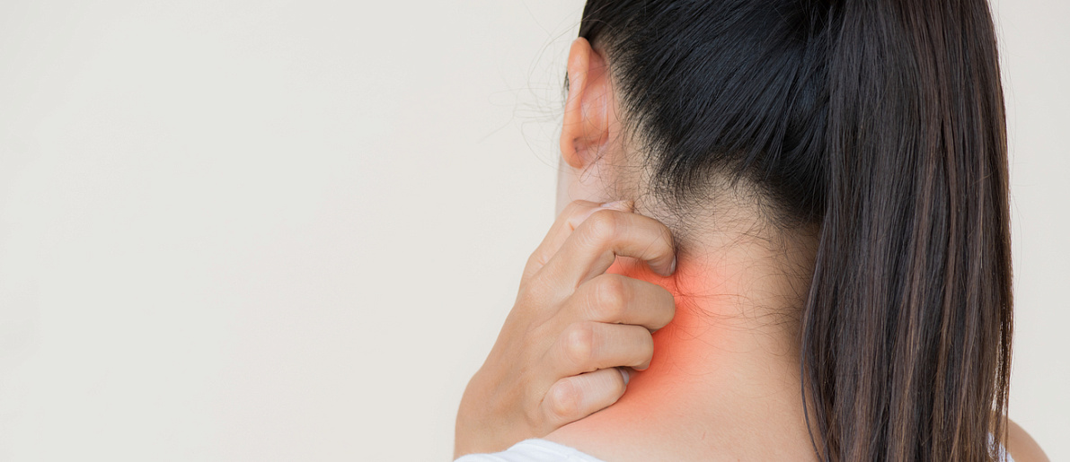 Причины прыщей на шее